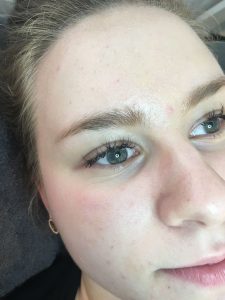 Permanent Make-up Augenbrauen vorher