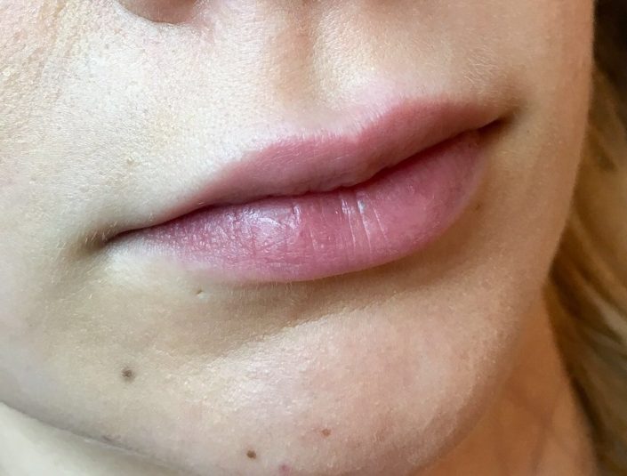 Permanent Make-up Lippen vorher